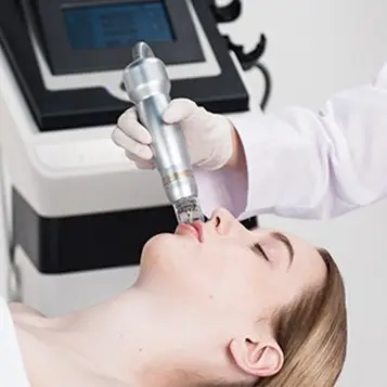 Woman receiving Sylfirm X RF microneedling treatment in Kuala Lumpur clinic